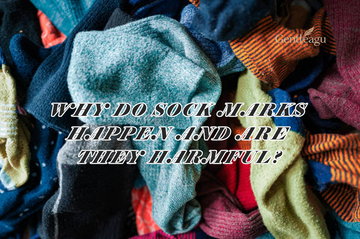 Why Do Sock Marks Happen and Are They Harmful?