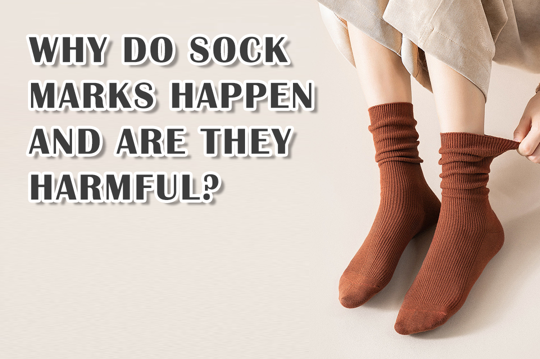 Why Do Sock Marks Happen and Are They Harmful?