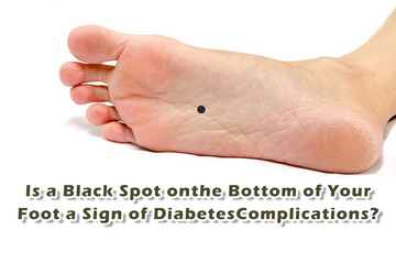 Is a Black Spot on the Bottom of Your Foot a Sign of Diabetes Complications?